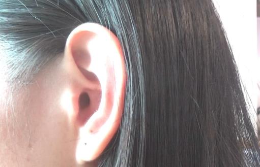 ����Ϊʲô�и�ʪ������ �򵥵Ķ��令������