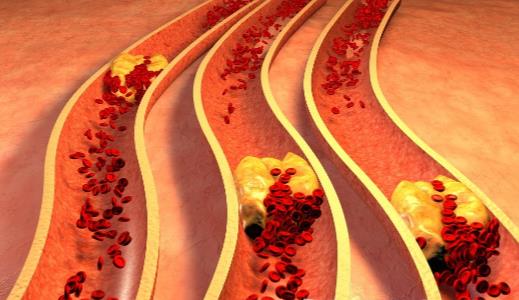 Ѫ��������ô�� �����߲˰���ͨѪ��