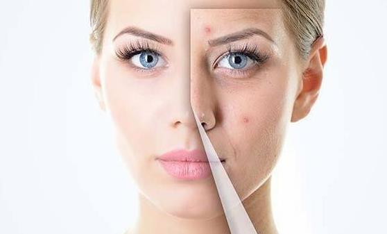 Ů����ʪ���ķ��� ע����ʳҪ���˶�