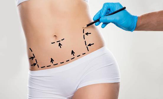 ������֬���ò�˵������ ��֬���ʲ��ʺ���Щ������Ⱥ