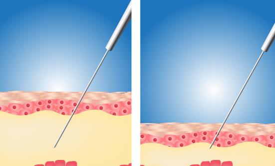 ������֬���ò�˵������ ��֬���ʲ��ʺ���Щ������Ⱥ